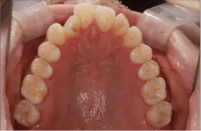 症例A 施術前写真その3