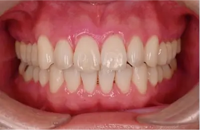 症例A 施術後写真その1