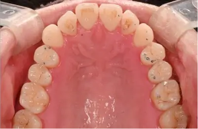 症例A 施術後写真その3