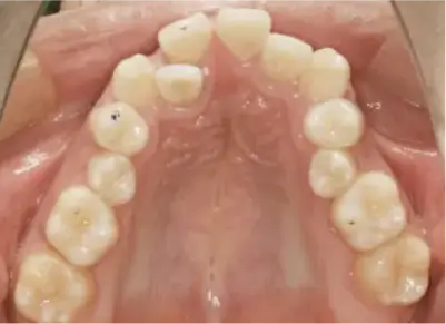 症例C 施術前写真その2