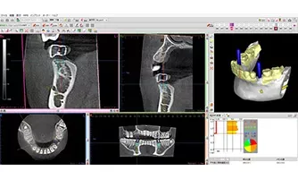 「人為的ミス」を排除する術式