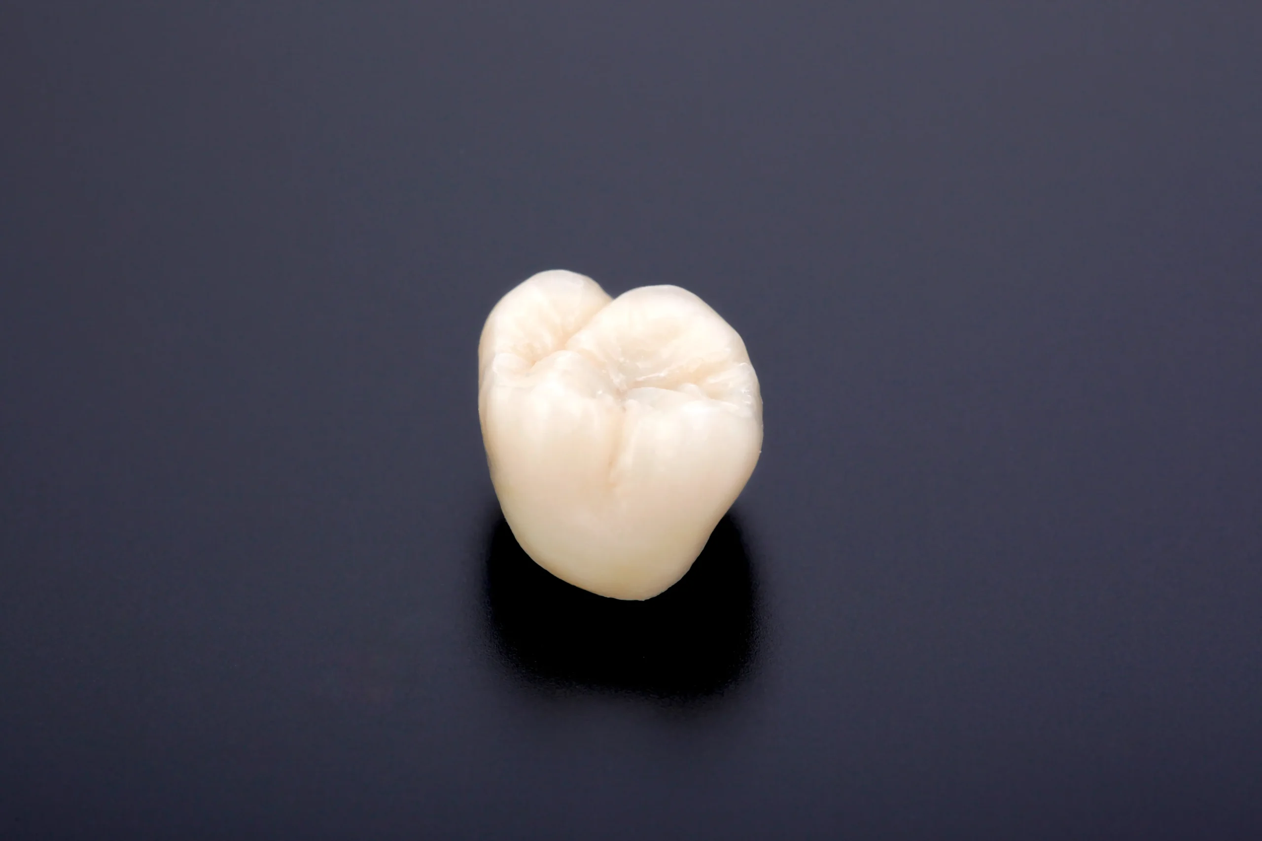 審美セラミック治療