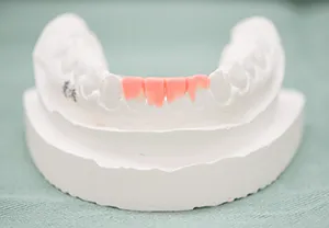 「セットアップ模型」によるイメージのすり合わせ