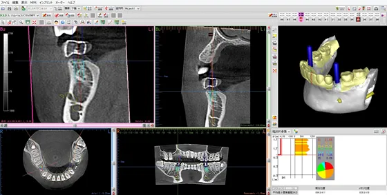シミュレーション