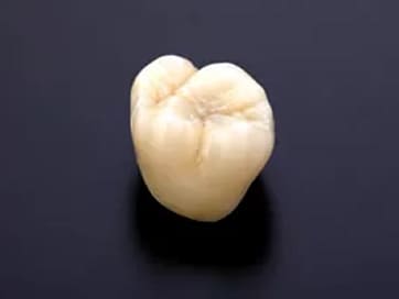 オールジルコニア